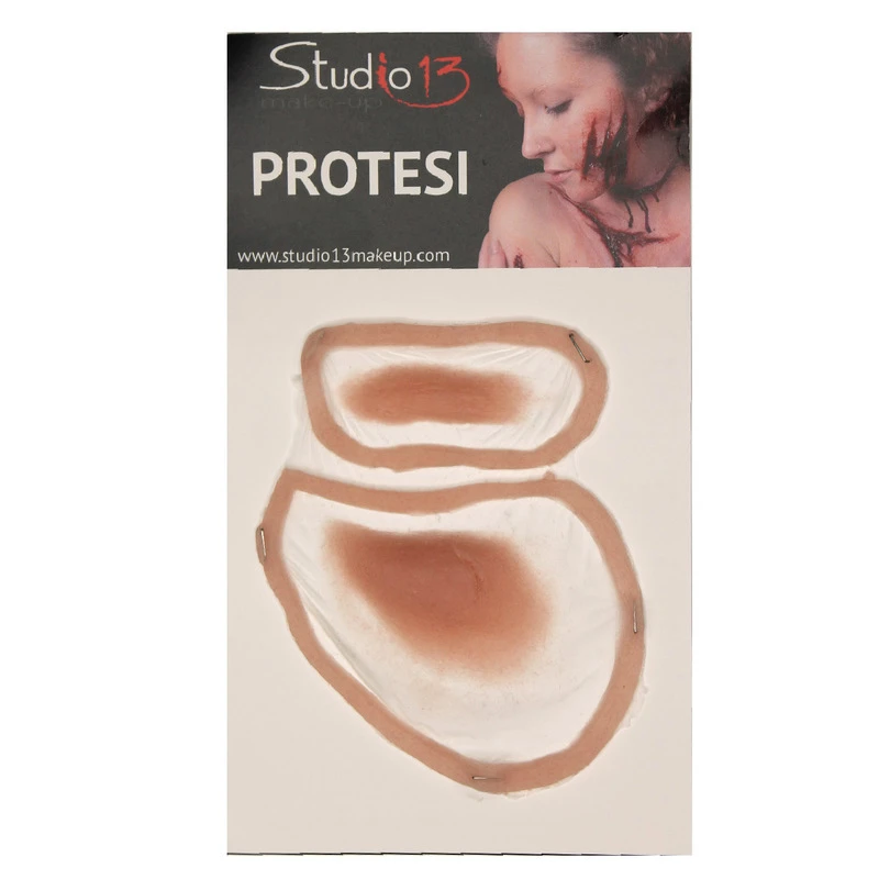 OCCHIO GONFIO Sinistro 3 OCCHIO GONFIO Sinistro