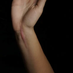 PROTESI SET CICATRICI CHELOIDI -Negozio Di Trucchi Per Effetti Speciali 800x800 stupr3202 protesi set cicatrici cheloidi 2